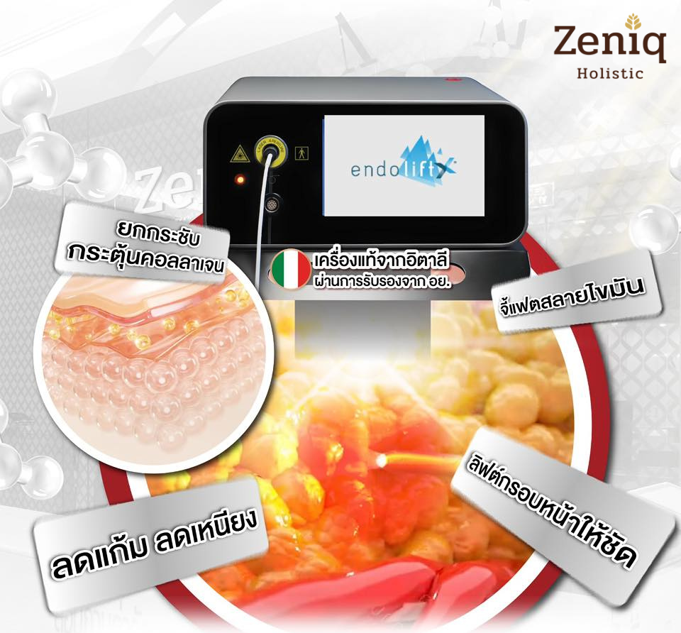 What is Endolift article