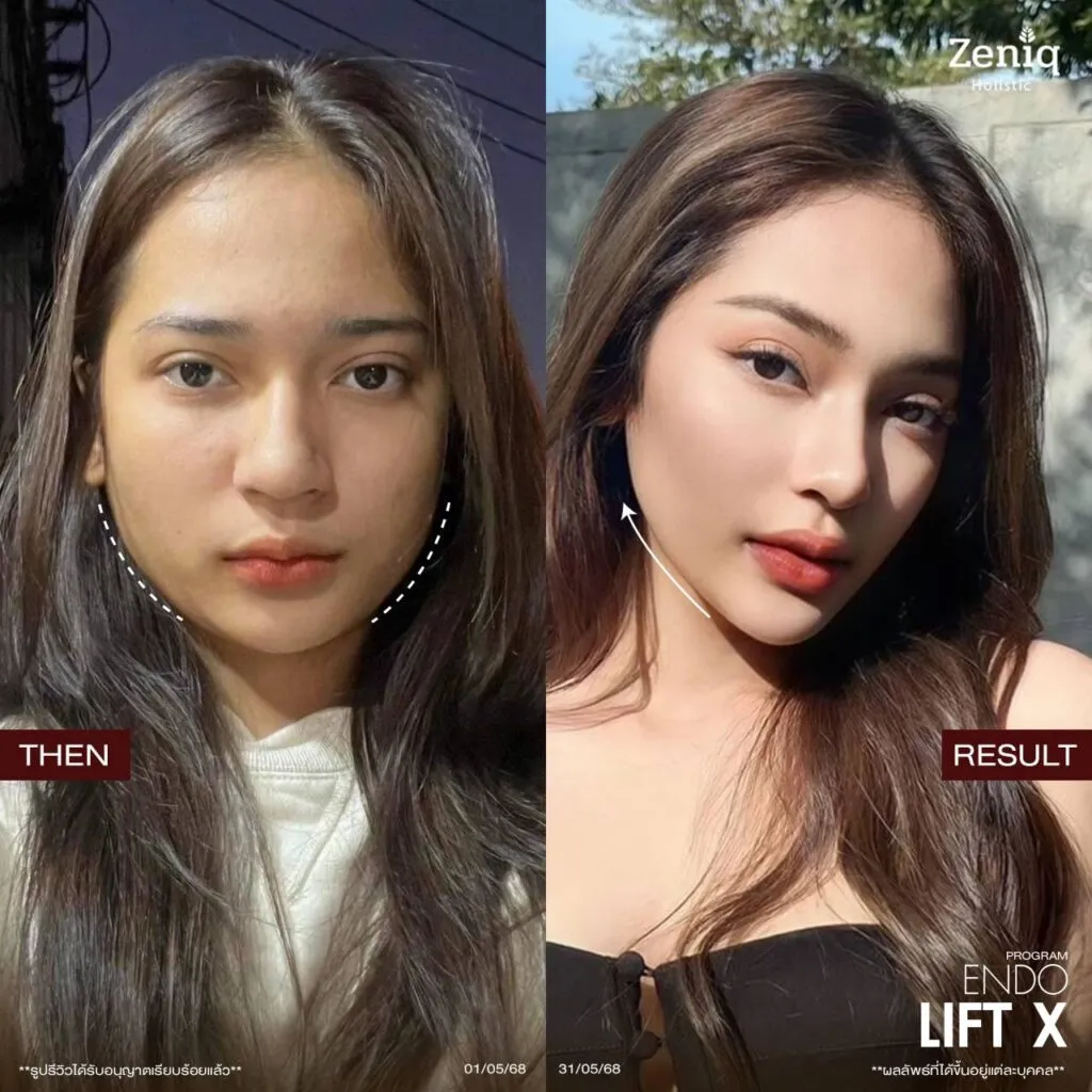 review Zeniq Holistic before after google review