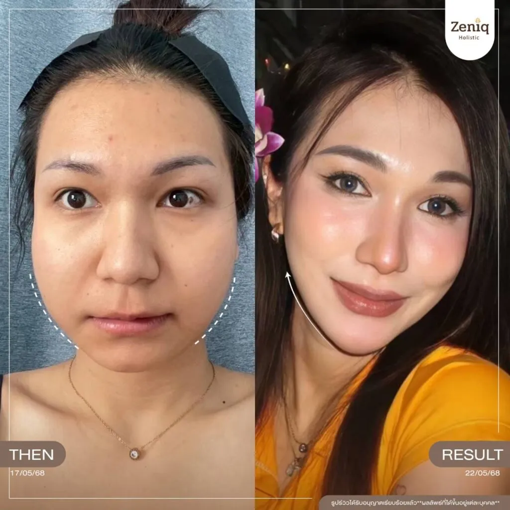 review Zeniq Holistic before after google review