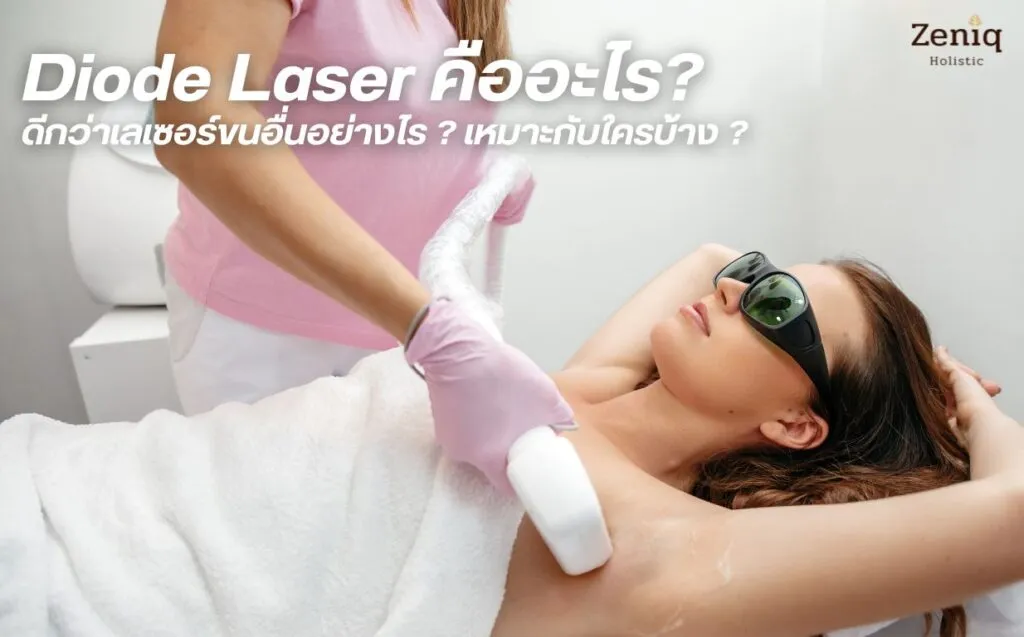 Diod laser service image