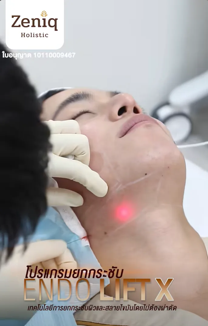 โปรแกรม Endolift X ยกกระชับหน้า ลดไขมัน คลินิก Zeniq Holistic