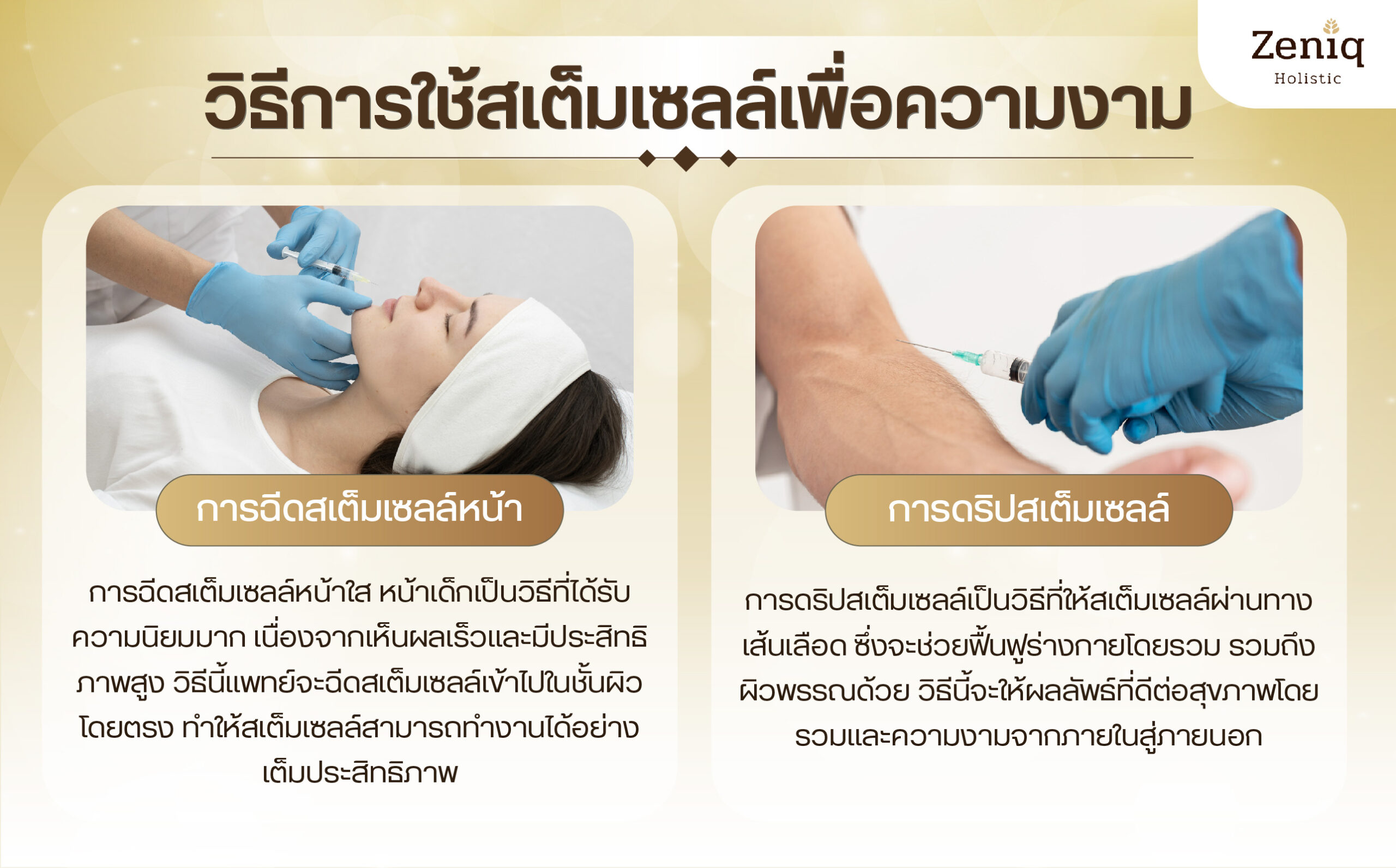 วิธีการใช้สเต็มเซลล์เพื่อความงาม