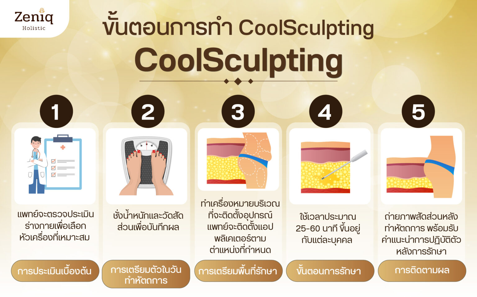 CoolSculpting ขั้นตอนการทำ