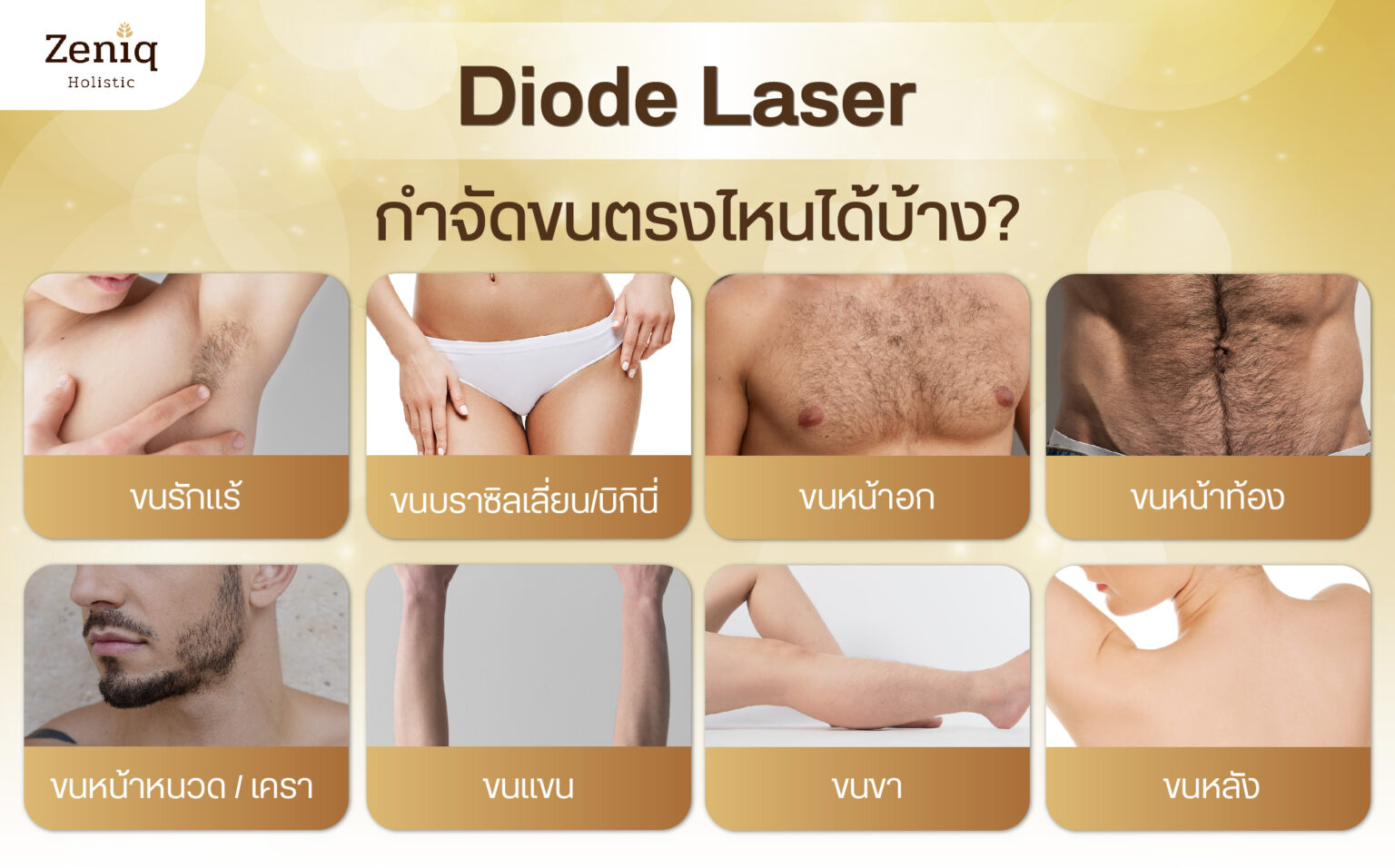 Diode Laser กำจัดขนตรงไหนได้บ้าง