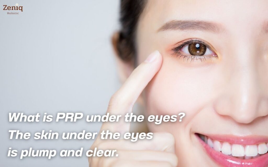 What is PRP under the eyes