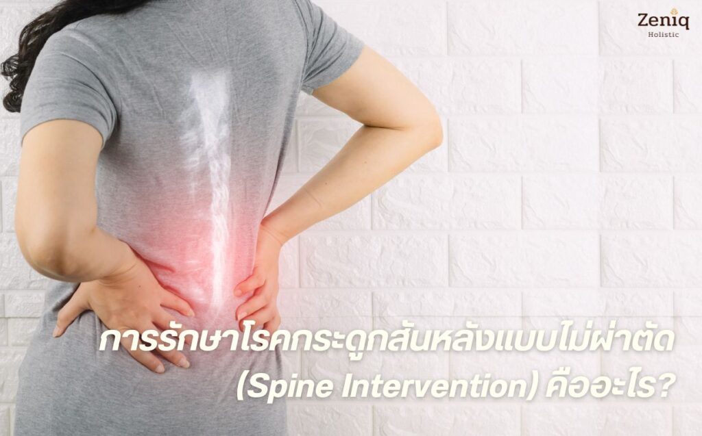 รักษาโรคกระดูกสันหลังแบบไม่ผ่าตัด (Spine Intervention)