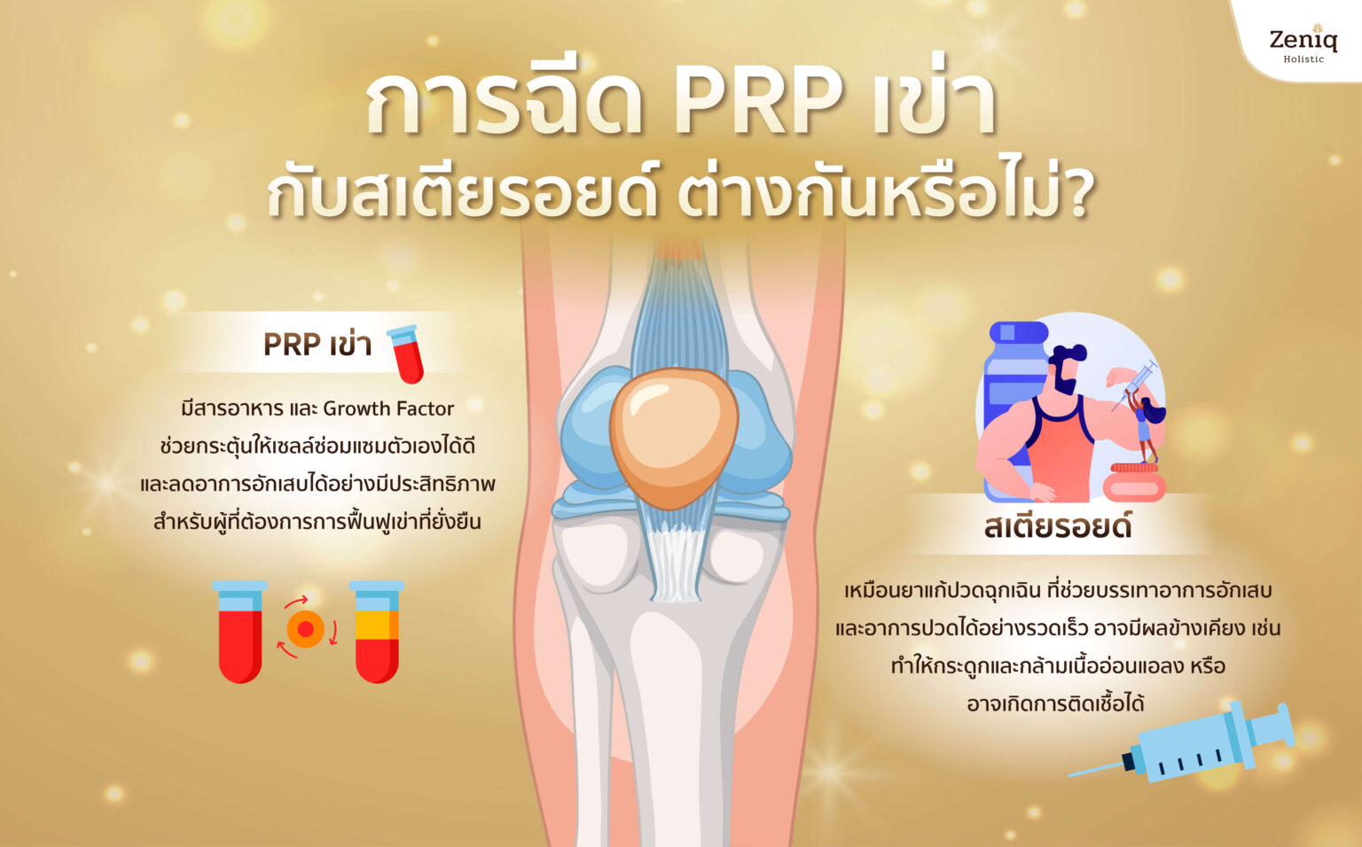 การฉีด PRP เข่า กับสเตียรอยด์ ต่างกันหรือไม่_