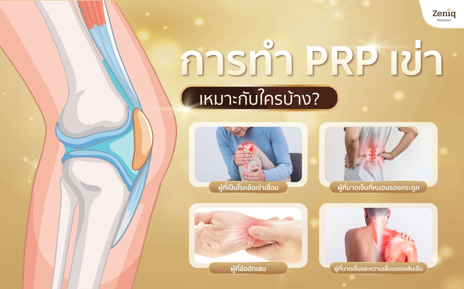 การทำ PRP เข่า เหมาะกับใครบ้าง