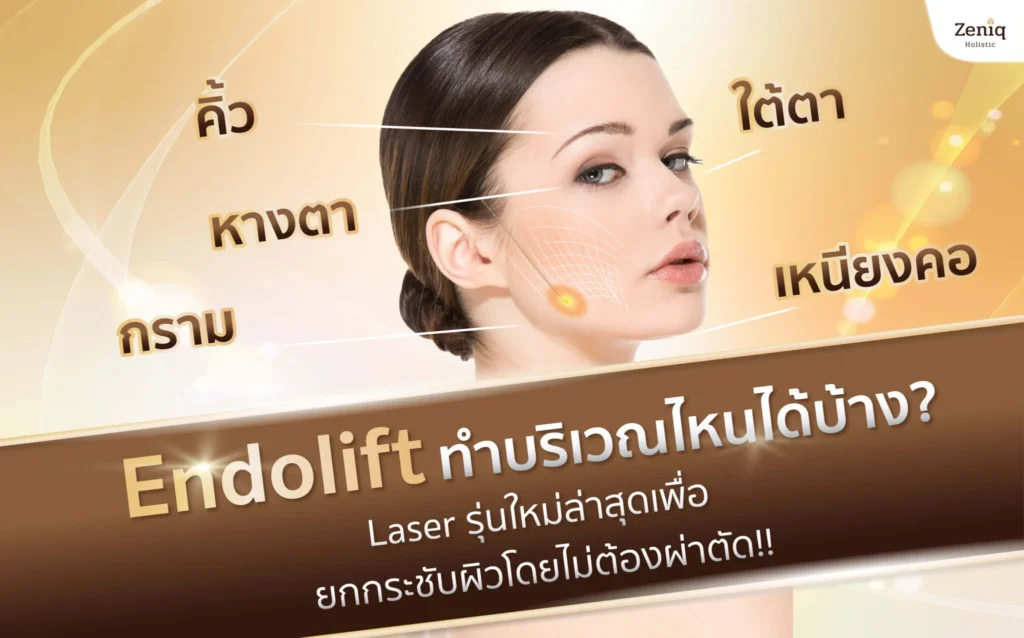 EndoliftX ทำบริเวณไหนได้บ้าง EndoliftXใบหน้าและลำคอ ช่วยยกกระชับผิวที่หย่อนคล้อย แก้ปัญหาแก้มหย่อน คางสองชั้น เหนียง กรอบหน้า แก้ไขหลุมสิว แผลเป็น และสามารถสลายไขมันส่วนเกินได้ รอบดวงตา ช่วยแก้ปัญหาผิวรอบดวงตาหย่อนคล้อย ริ้วรอยใต้ตา หนังตาตก ถุงใต้ตา และยกคิ้วให้ได้รูป ลำตัว สามารถทำได้กับหลายส่วน เช่น ต้นแขน หน้าท้อง สะโพก ต้นขา ช่วยให้ผิวกระชับขึ้น ลดรอยแตกลาย และสลายไขมันส่วนเกิน