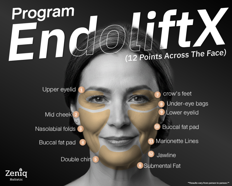 Endolift X Downsides: Side Effects, Limitations and Who Should Avoid It