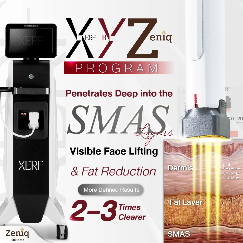 xerf